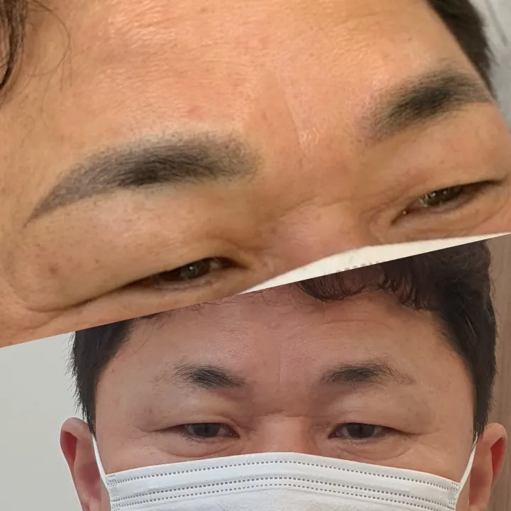 남자 눈썹 잔흔 커버업