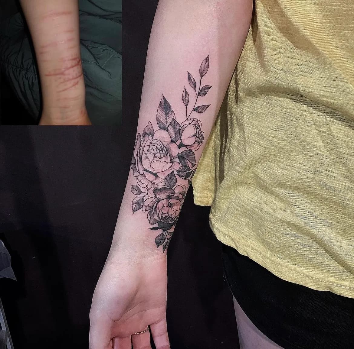 ๊ฝ ํํฌ - 1