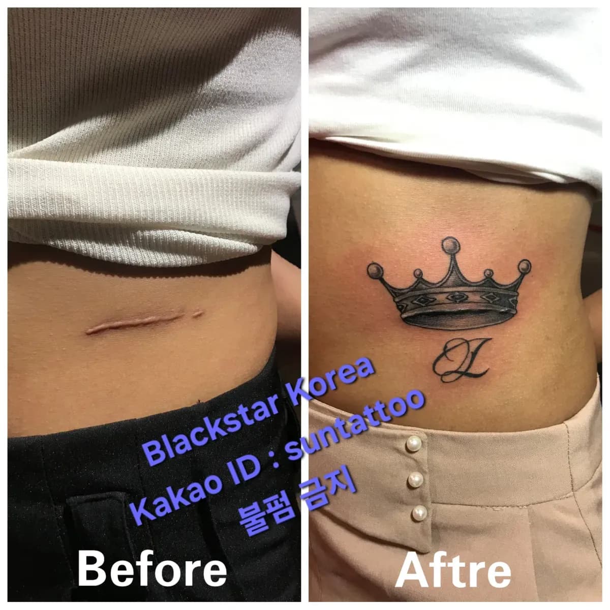 ์๊ตฌ๋ฆฌ ์๊ด ์ปค๋ฒ์
ํํฌ