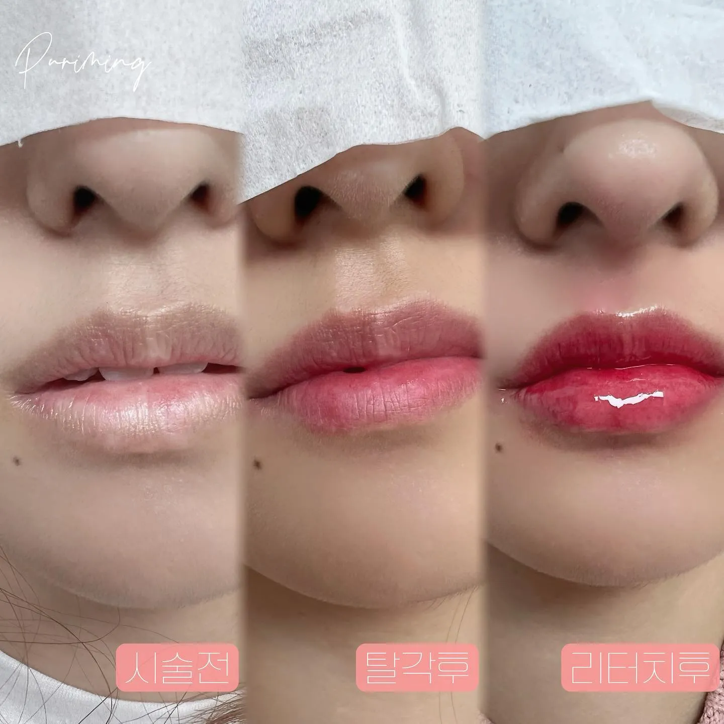 ⠀나눠서 보니 차이 확실하쥬?👍🥰