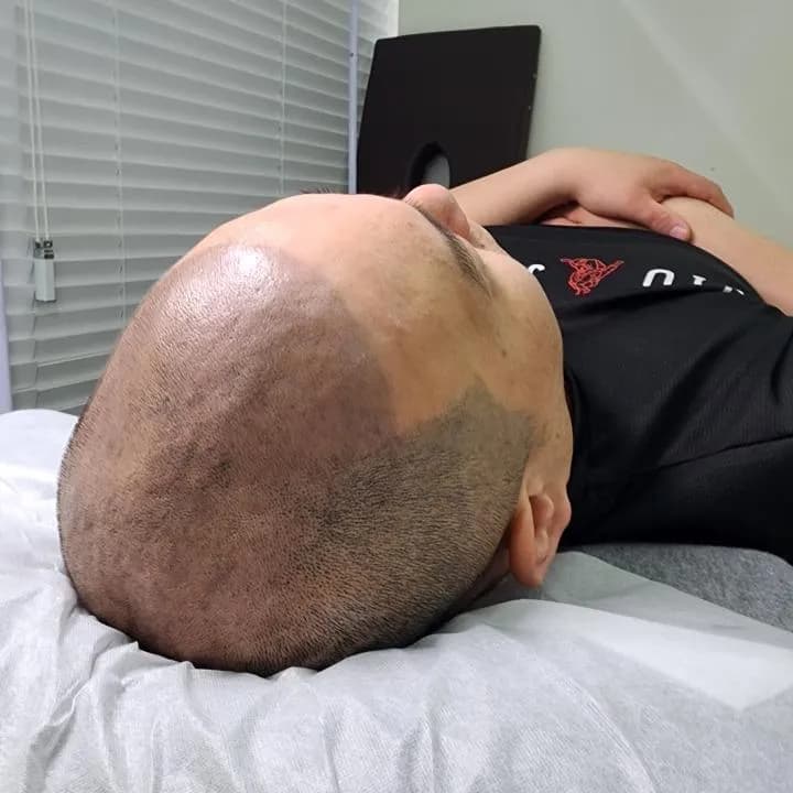 삭발디자인 두피문신