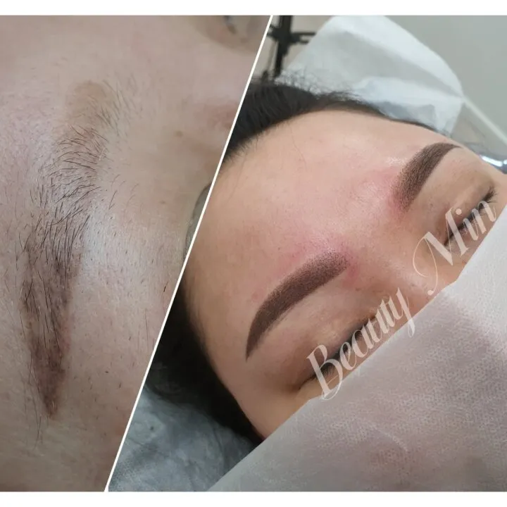 여자 눈썹 수정 커버업