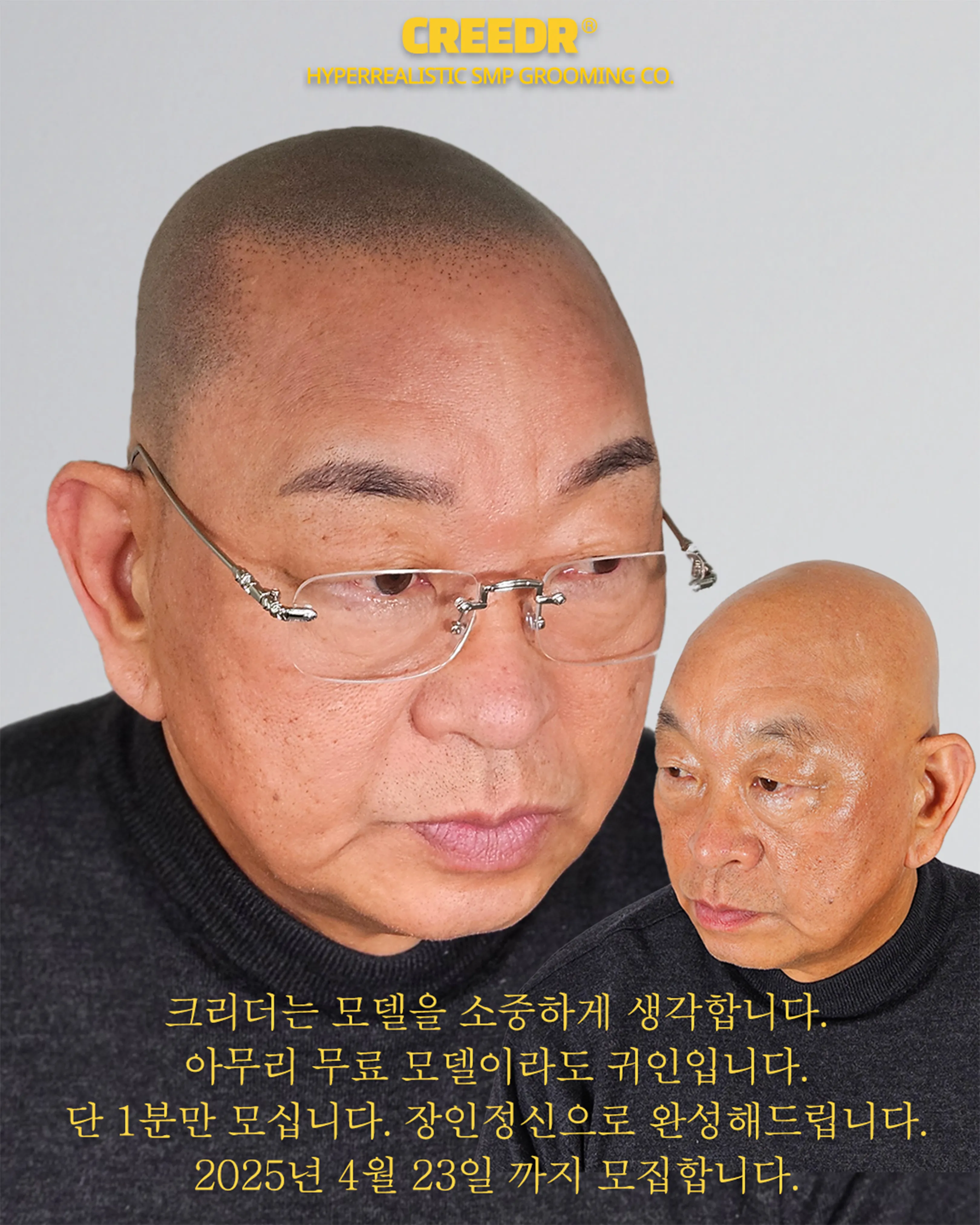 전액 무료 대전두피문신 모델 모집 - 1