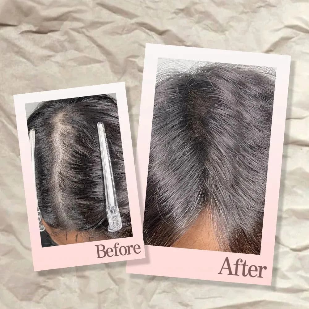 가르마탈모커버