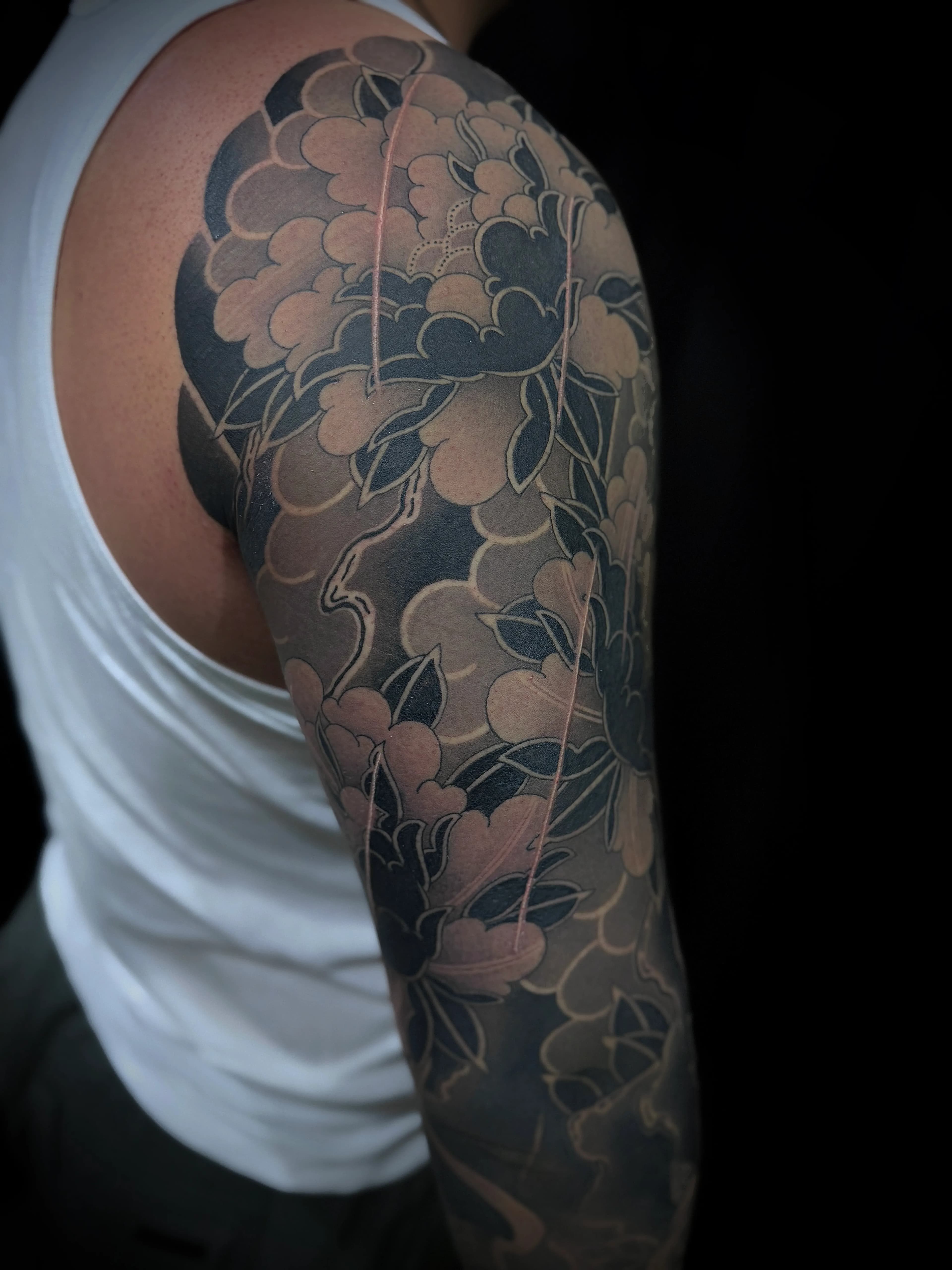 ๊ธดํ ์ด๋ ์ฆ๋ฏธํํฌ