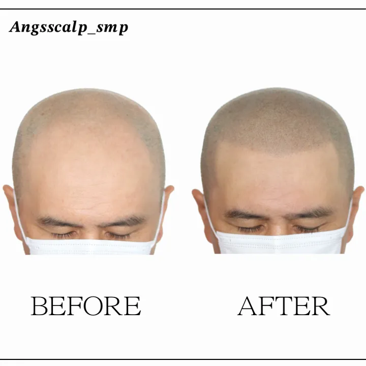 ๋ฏผ๋จธ๋ฆฌ / ์ญ๋ฐ์ผ์ด์ค ๋ํผ๋ฌธ์